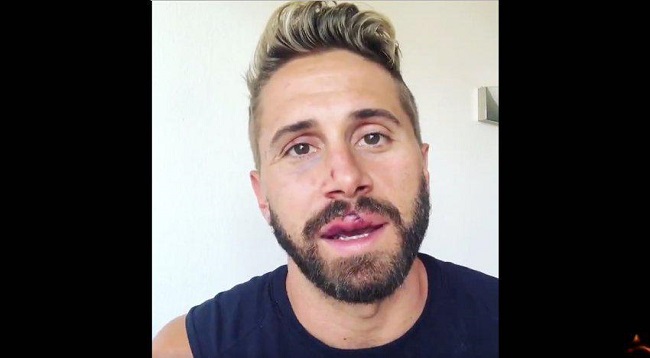 Gay Porn Star Wesley Woods Gay Bashing Attack
